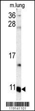 S100A6 Antibody