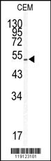 KLF5 Antibody