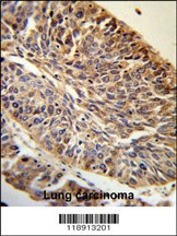 PITX1 Antibody