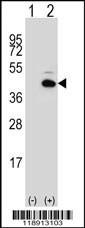 PITX1 Antibody