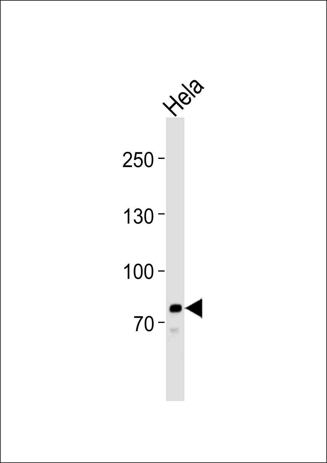 PCSK9 Antibody