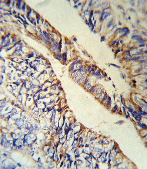 PCSK9 Antibody