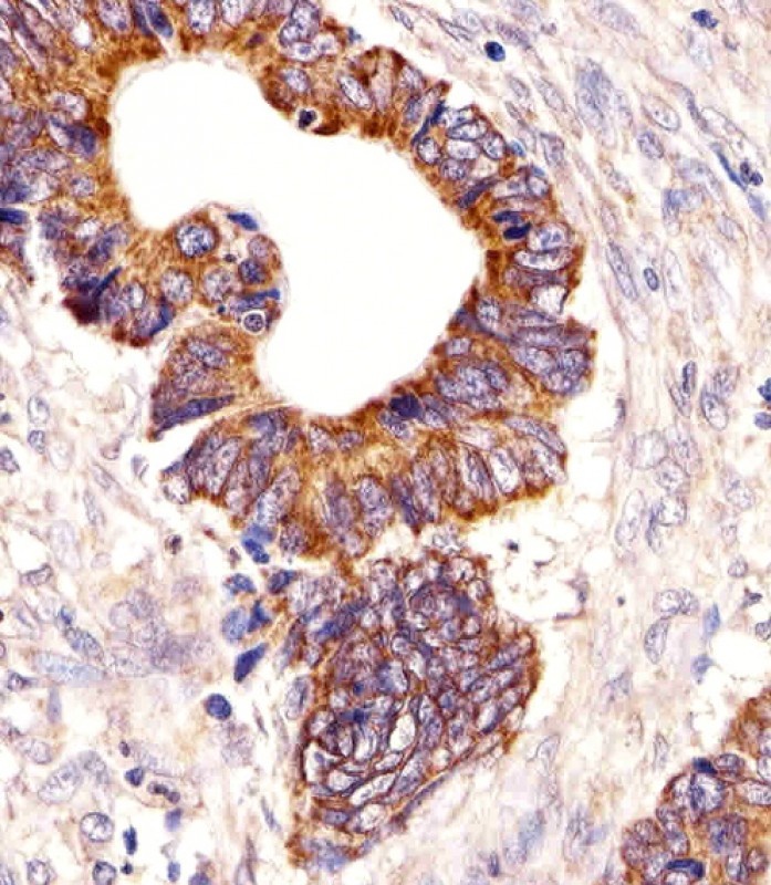 PCSK9 Antibody