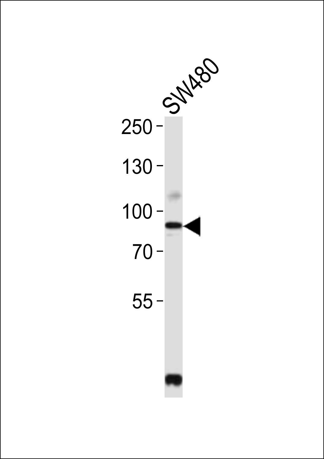 PCSK9 Antibody