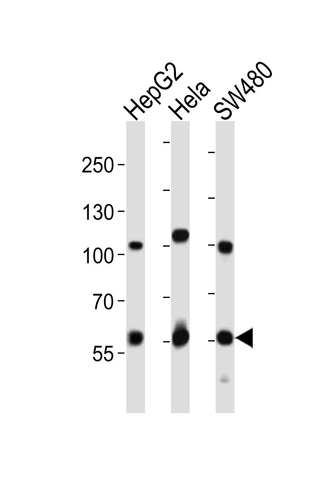 PCSK9 Antibody