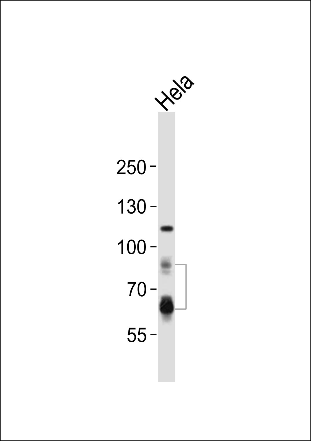 PCSK9 Antibody