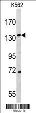 CD163 Antibody