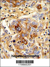 CD163 Antibody