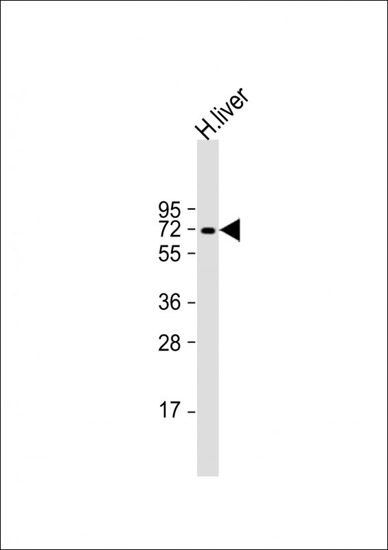 SERPINA3 Antibody