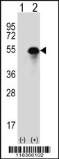 CA14 Antibody