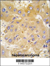 LAP3 Antibody