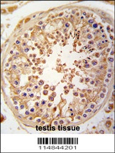 SPAG9 Antibody