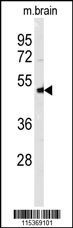 NPTX1 Antibody