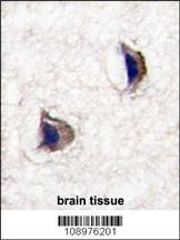 NP1 Antibody