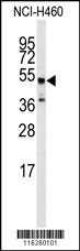 ADRB2 Antibody