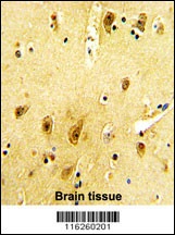 ADRB2 Antibody