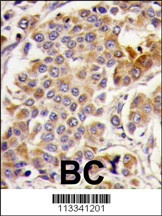 AMPK alpha Antibody