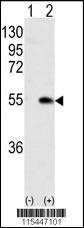 CAMK1G Antibody