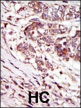 CAMK1G Antibody