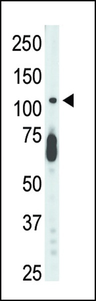 CDKL5 Antibody