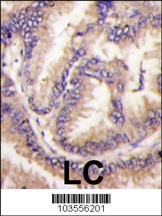 CDKL5 Antibody