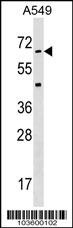 STK35 Antibody