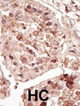 STK31 Antibody