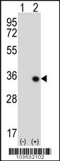 STK16 Antibody