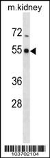 PHKG2 Antibody