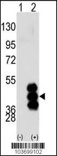 PHKG2 Antibody