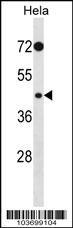 PHKG2 Antibody