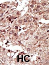 PHKG1 Antibody