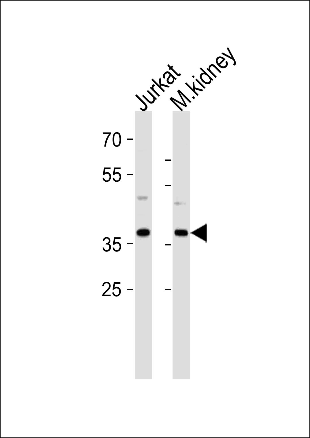 MAPK14 Antibody