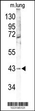 MAPK12 Antibody