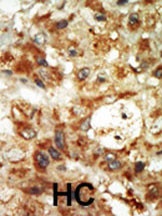 MAPK12 Antibody