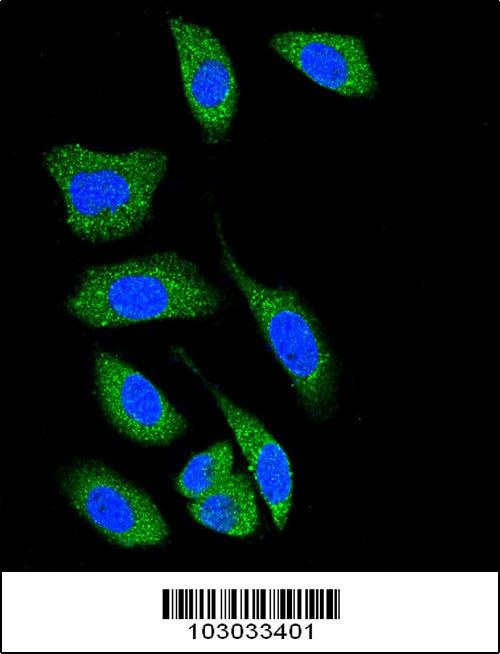 DAPK1 Antibody