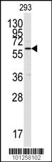 CAMK2A Antibody