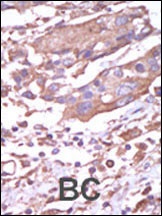 CAMK2A Antibody