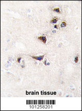 CAMK2A Antibody