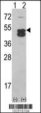 CAMK1D Antibody