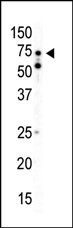 AMPK alpha2 Antibody