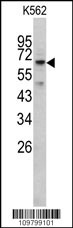 RIOK1 Antibody