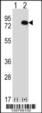 RIOK1 Antibody