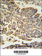 HSP27 Antibody