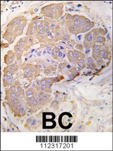 HSPB1 Antibody