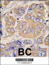 HSP27 Antibody