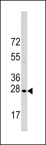 HSP27 Antibody