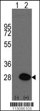 HSP27 Antibody