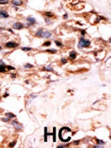 UCKL1 Antibody