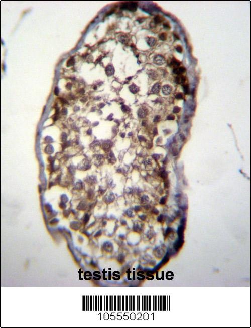 UCK2 Antibody